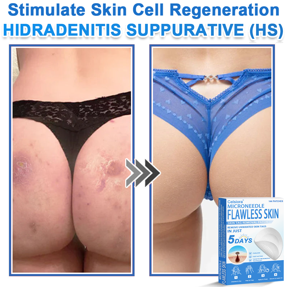 🎁 Celsiora® 2-in-1 Microneedle & Hydrocolloid Patch | Raised Moles,Acne,  Flat Warts & Skin Tags Remover | Improves Wrinkles, Scars & Blemishes | Invisible Pimple Patches for Face & Body | 144 Count