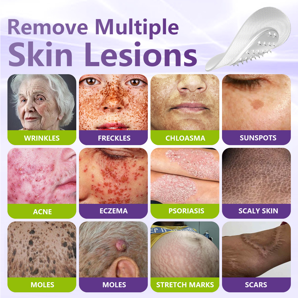 ✅NESLEMY® Soluble Microneedle Botanical Skin Tag Removal Patch