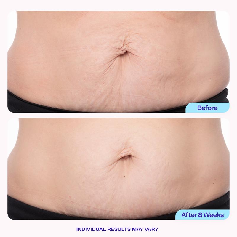Tighten & Smooth Belly Firming Cream
