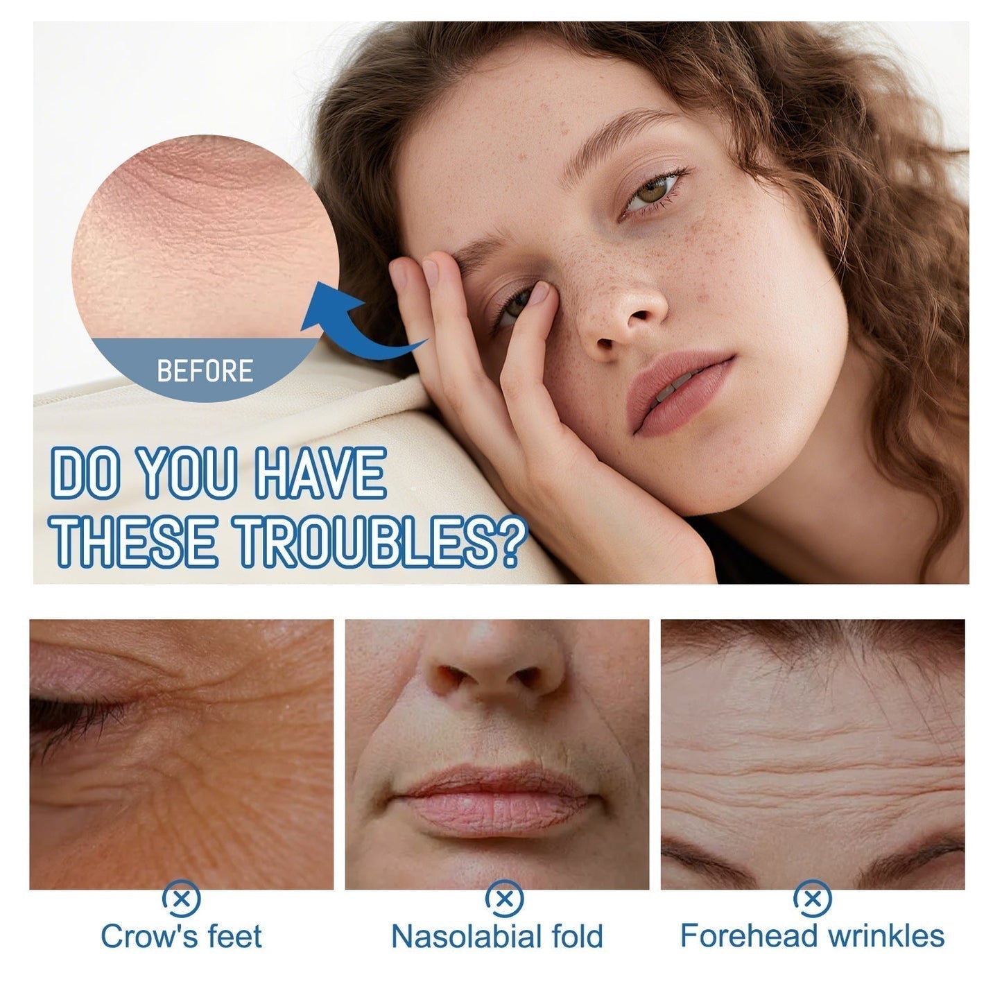 ZORTRIO™ Instant Face Temporary Tightener – Instant visible results in 30 seconds