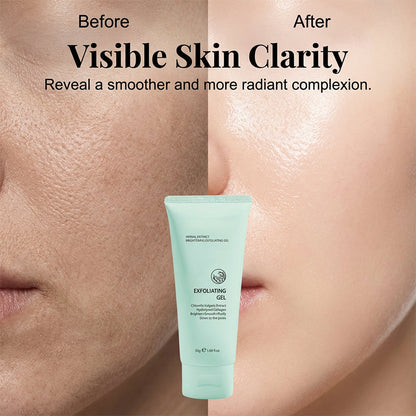 🥳2026 HOT SALE🥳💞50K+ SOLD!💥👵🌸 50% OFF!Herbal Extract Brightening Exfoliating Gel